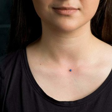 Anya-mikrodermal-1024x682