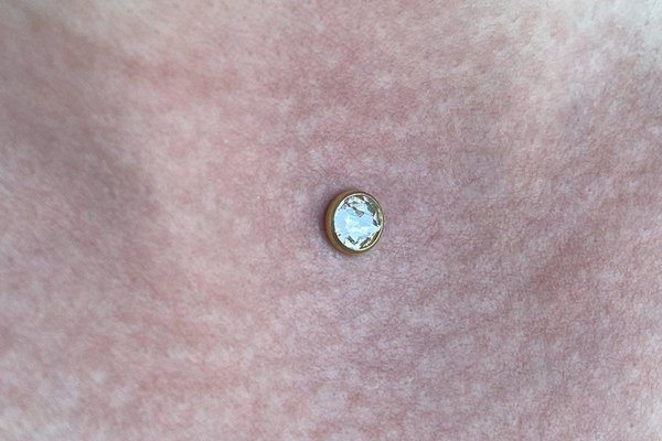 Microdermal12