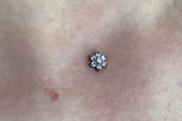 Microdermal16