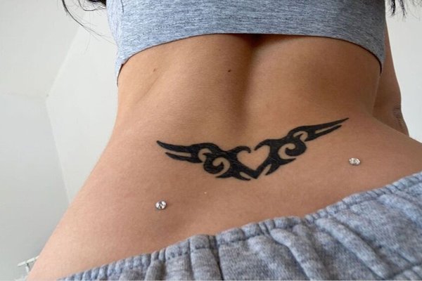 Microdermal2